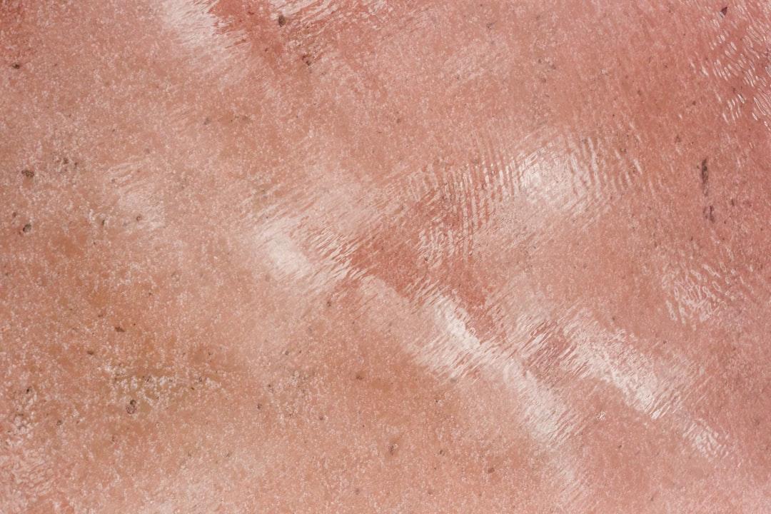 découvrez les causes, traitements et conseils pour gérer l'acné infantile. apprenez à distinguer les types d'acné chez les bébés et à adopter les meilleures pratiques pour la peau délicate de votre enfant.