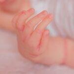 découvrez les causes et les solutions de l'acné infantile. apprenez à reconnaître les symptômes, à éviter les irritations cutanées et à prendre soin de la peau délicate de votre bébé.