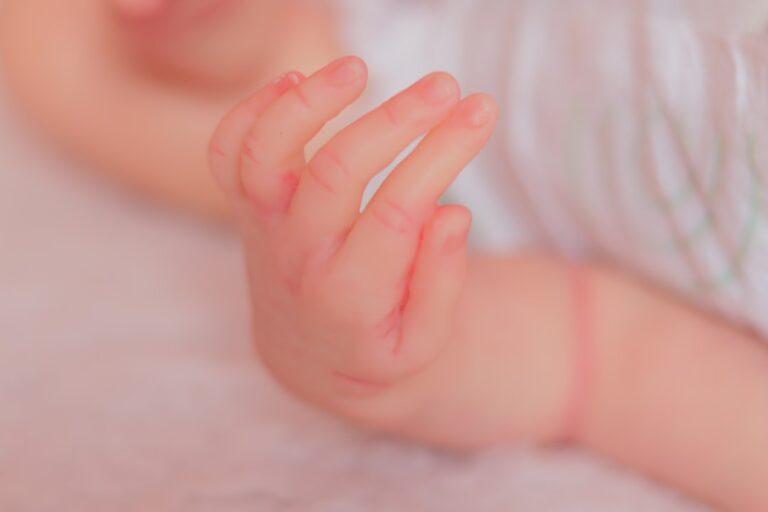 découvrez les causes et les solutions de l'acné infantile. apprenez à reconnaître les symptômes, à éviter les irritations cutanées et à prendre soin de la peau délicate de votre bébé.