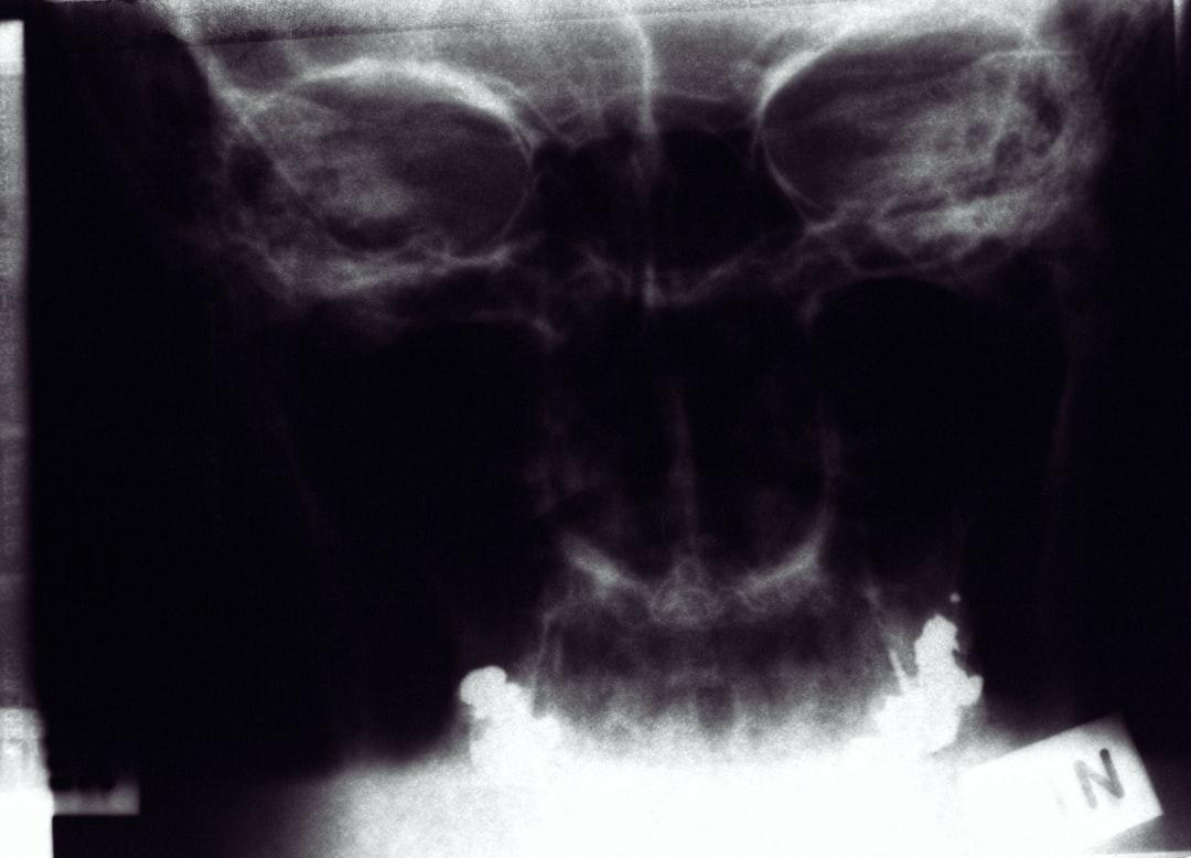 découvrez les causes, symptômes et traitements de la dysfonction de la symphyse pubienne. apprenez comment cette condition peut affecter votre quotidien et les meilleures approches pour soulager la douleur et améliorer votre mobilité.