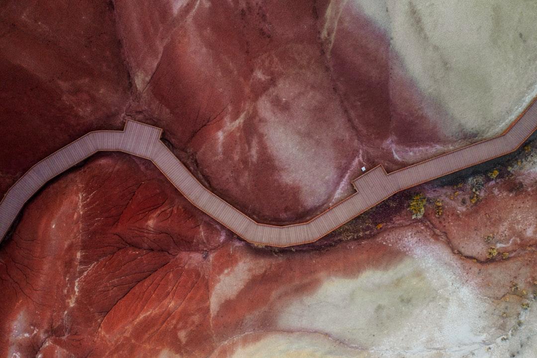 découvrez tout ce que vous devez savoir sur la dilatation cervicale, un processus essentiel de la grossesse. apprenez à reconnaître les signes, les étapes et l'importance de ce phénomène pour la préparation à l'accouchement.