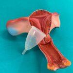 découvrez tout sur la dilatation cervicale, une étape cruciale du travail. comprenez son importance, son processus et ce à quoi vous attendre lors de cet événement clé de la grossesse.