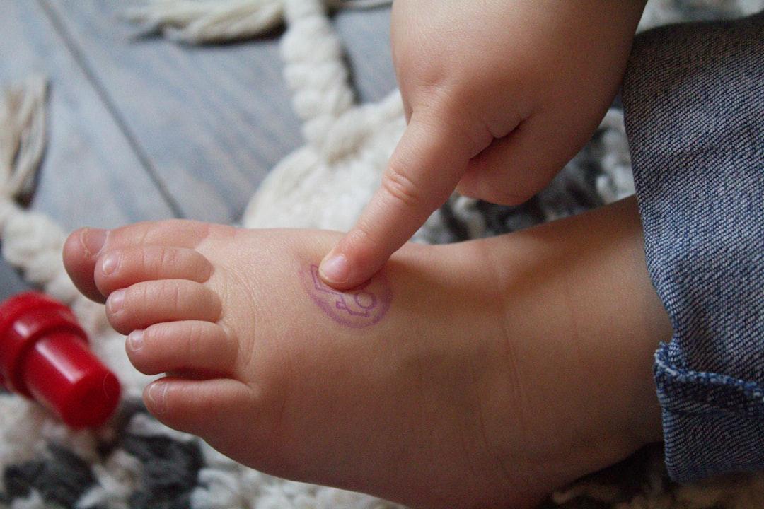 découvrez tout sur l'ongle incarné : causes, symptômes et traitements efficaces pour soulager la douleur et éviter les complications. prenez soin de vos pieds avec nos conseils pratiques.