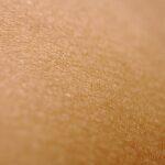 découvrez les causes, les symptômes et les traitements des éruptions cutanées. informez-vous sur les différents types de rougeurs et apprenez quand consulter un professionnel de santé pour un soulagement efficace.