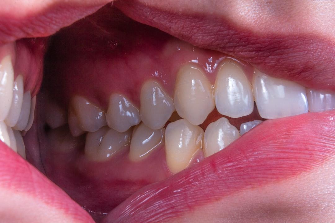 découvrez des conseils pratiques et des astuces pour soulager les douleurs liées à la poussée dentaire chez les bébés. apprenez à reconnaître les symptômes et à choisir les meilleurs remèdes pour apaiser votre enfant pendant cette période délicate.