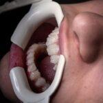 Comprendre les signes des poussées dentaires chez votre bébé découvrez des conseils et astuces pour apaiser les douleurs liées à la dentition de votre bébé. apprenez à reconnaître les signes de la pousse dentaire et explorez des solutions naturelles pour rendre cette étape plus confortable pour votre enfant.