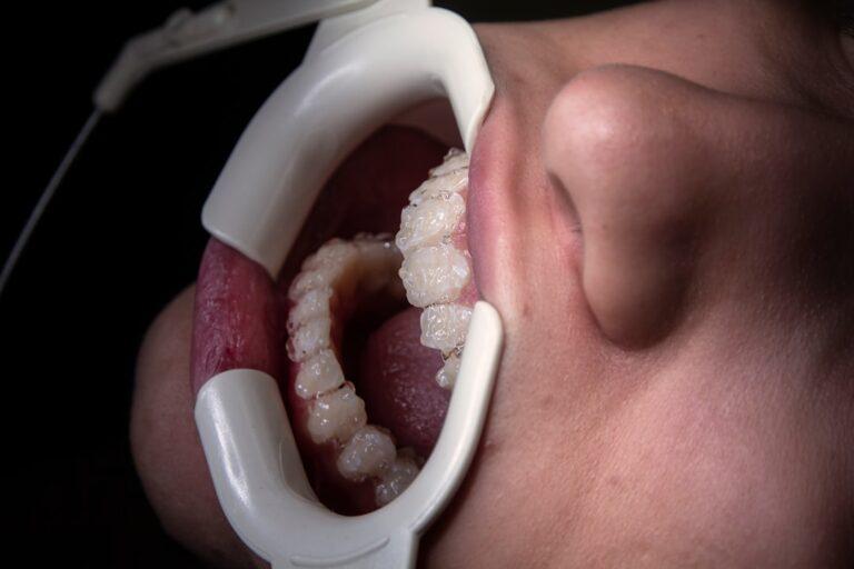 découvrez des conseils et astuces pour apaiser les douleurs liées à la dentition de votre bébé. apprenez à reconnaître les signes de la pousse dentaire et explorez des solutions naturelles pour rendre cette étape plus confortable pour votre enfant.