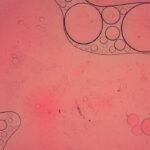 Comprendre la toxoplasmose pendant la grossesse : signes à surveiller et options de traitement découvrez tout ce qu'il faut savoir sur la toxoplasmose, une infection parasitaire courante. apprenez sur ses symptômes, sa transmission, les risques associés et les moyens de prévention pour protéger votre santé et celle de vos proches.