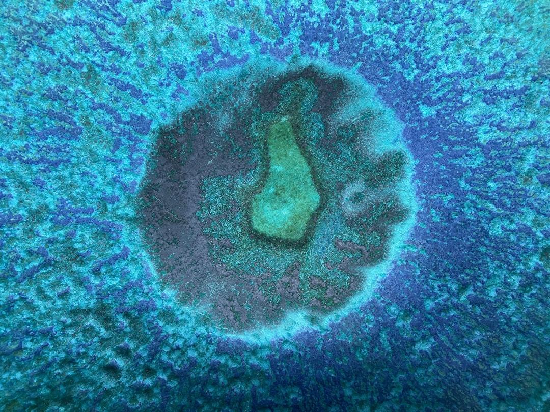 découvrez tout ce qu’il faut savoir sur l’amniocentèse : indications, déroulement de l’examen, risques et conseils pour les femmes enceintes concernés par ce test prénatal.