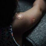 Comprendre les cicatrices de césarienne : types, soins et impacts découvrez tout sur les cicatrices de césariennes : leur apparition, leur guérison et des conseils pour en prendre soin. apprenez à comprendre et à gérer votre cicatrice pour mieux vivre cette expérience.