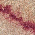 Comprendre la varicelle chez les bébés et son impact durant la grossesse découvrez tout sur la varicelle : causes, symptômes, traitement et prévention de cette maladie infantile courante. conseils et informations pour protéger votre famille.