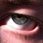 découvrez tout sur la conjunctivite : causes, symptômes et traitements pour soulager l'irritation oculaire. informez-vous sur cette affection commune et comment prévenir sa propagation.