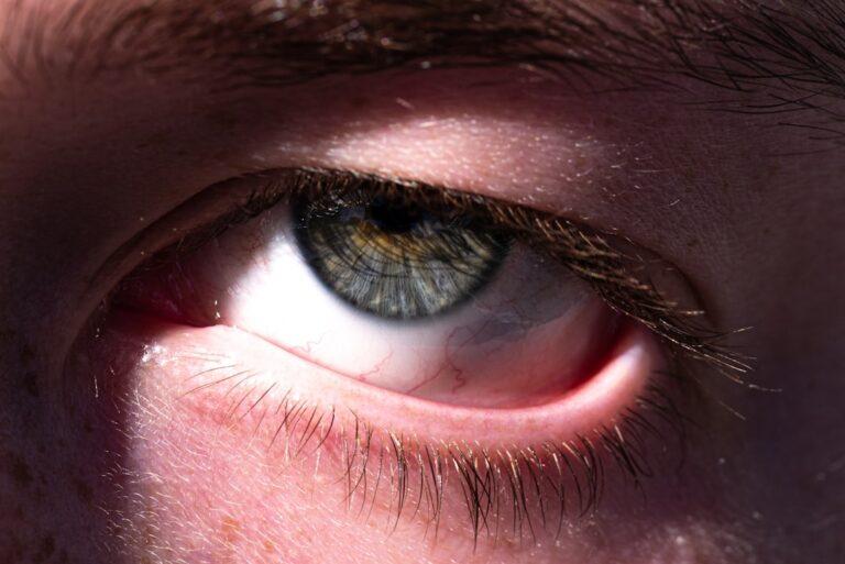 découvrez tout sur la conjunctivite : causes, symptômes et traitements pour soulager l'irritation oculaire. informez-vous sur cette affection commune et comment prévenir sa propagation.