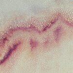 Comprendre le diastasis des grands droits durant et après la grossesse découvrez tout ce qu'il faut savoir sur le diastasis : causes, symptômes, traitements et conseils pour renforcer la sangle abdominale après une grossesse ou un effort physique important.