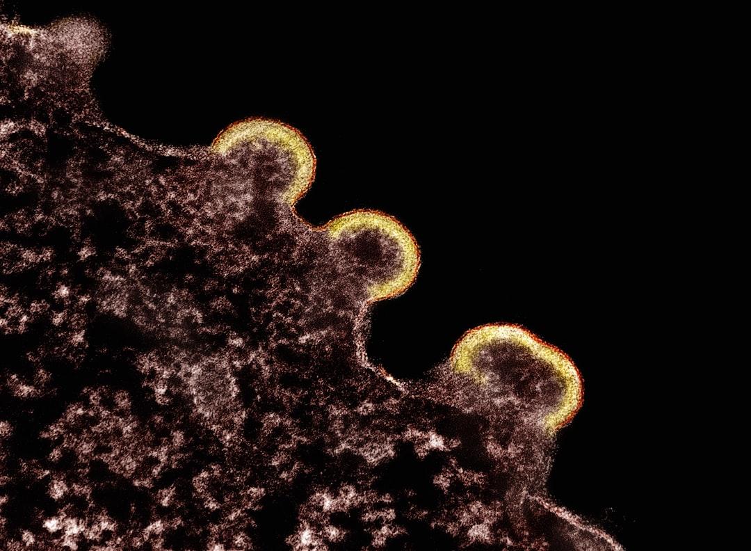 découvrez tout ce qu'il faut savoir sur la cinquième maladie, une infection virale courante chez les enfants. symptômes, causes, traitements et conseils pour la prévention.