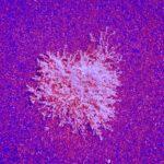 La cinquième maladie : tout savoir sur ses symptômes, traitements et conseils de prévention découvrez tout ce qu'il faut savoir sur la cinquième maladie (érythème infectieux) : symptômes, causes, transmission et conseils pour la prévention et le traitement, particulièrement chez les enfants.