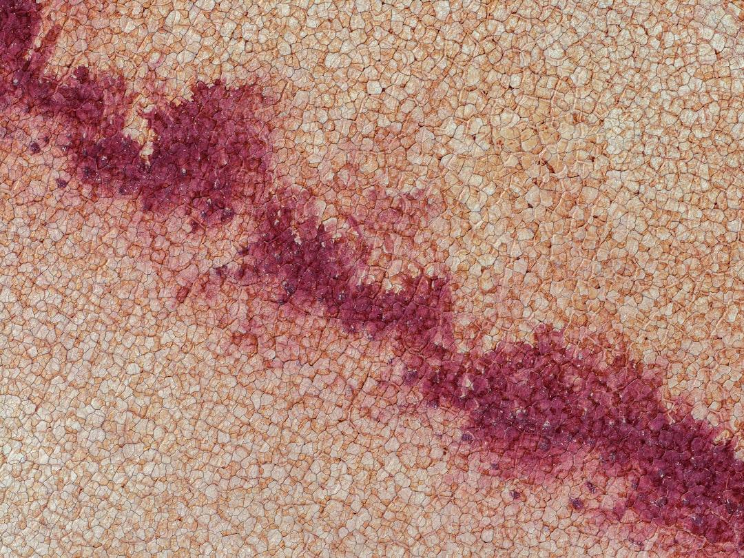 découvrez tout ce qu'il faut savoir sur la cinquième maladie (fifth disease) : symptômes, transmission, traitement et prévention de cette infection virale fréquente chez les enfants.