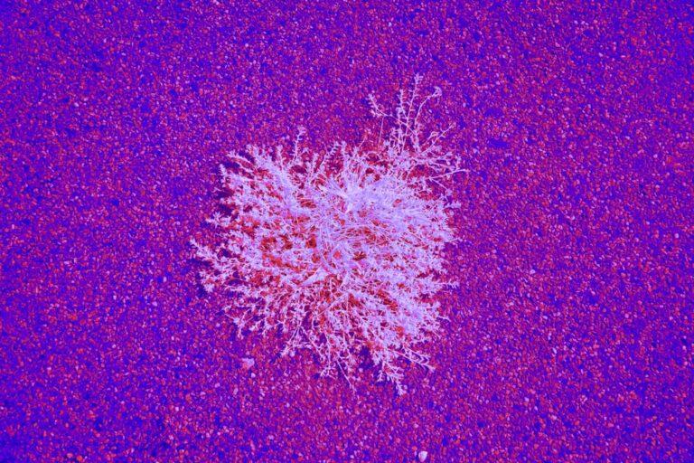 découvrez tout ce qu'il faut savoir sur la cinquième maladie (érythème infectieux) : symptômes, causes, transmission et conseils pour la prévention et le traitement, particulièrement chez les enfants.