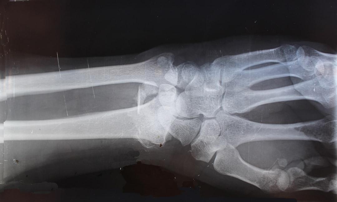 découvrez les types de blessures au genou, leurs causes, symptômes fréquents et options de traitement afin d'assurer une meilleure récupération et prévenir les récidives.