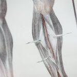 Comment traiter les éraflures, coupures et contusions au genou découvrez les différentes blessures au genou, leurs causes, symptômes, traitements et conseils de prévention pour retrouver mobilité et bien-être.