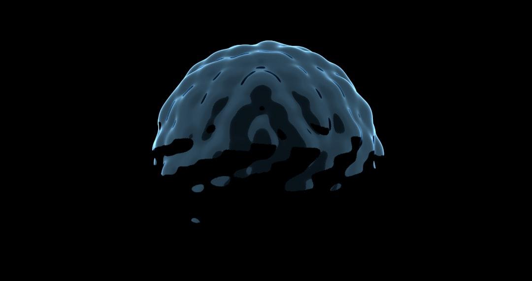 découvrez les troubles de la mémoire : causes, symptômes, diagnostic et traitements pour mieux comprendre et gérer ces pathologies au quotidien.