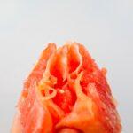 Comprendre le placenta accreta : signes, origines et dangers associés découvrez tout ce qu'il faut savoir sur le placenta accreta : causes, symptômes, complications possibles et traitements disponibles pour cette pathologie rare de la grossesse.