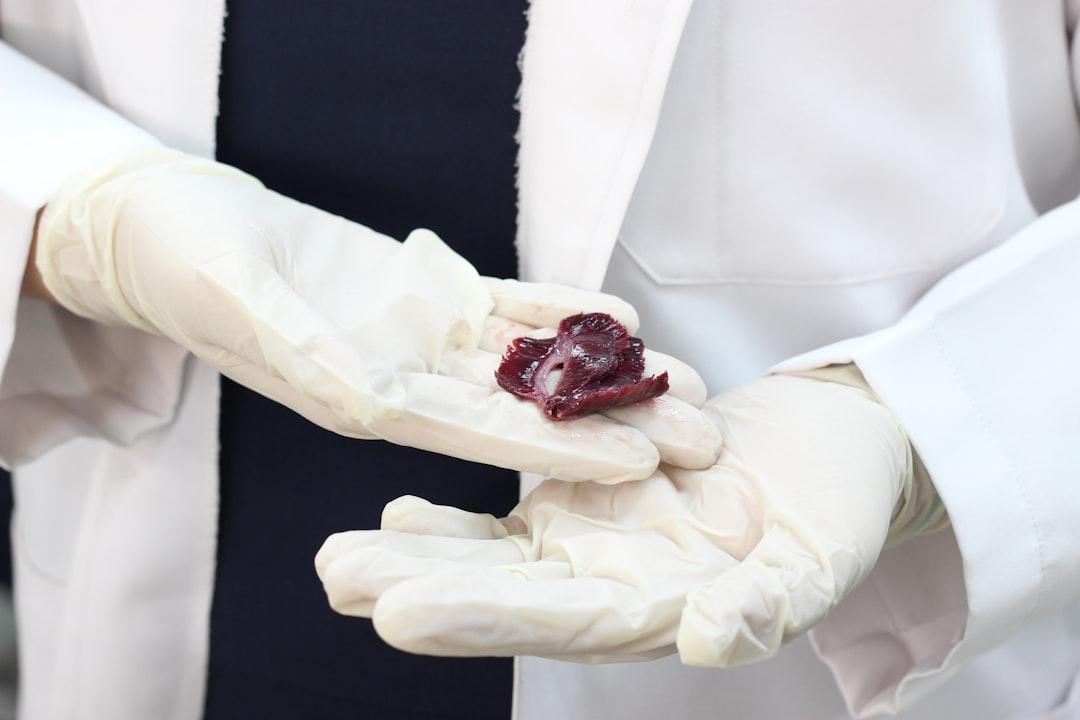découvrez ce qu'est le placenta accreta, une complication rare de la grossesse où le placenta s'attache trop profondément à la paroi utérine, ses causes, symptômes, risques et options de prise en charge médicale.