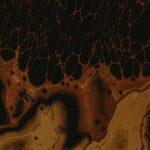 Comprendre la pré-éclampsie : ses définitions, signes d'alerte et options de traitement découvrez tout sur la prééclampsie : causes, symptÎmes, risques pour la grossesse et conseils pour la prévention et le traitement de cette complication grave chez la femme enceinte.