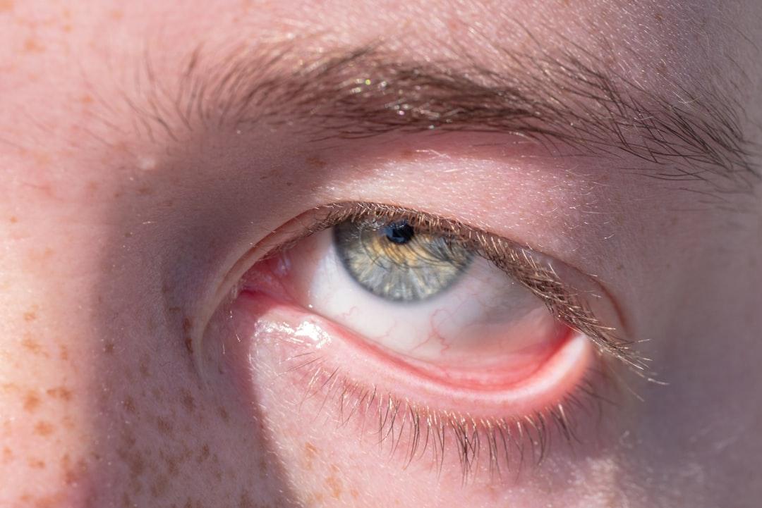 découvrez les symptômes courants des maladies et conditions médicales. apprenez à reconnaître les signes d'alerte pour une prise en charge rapide et efficace de votre santé.