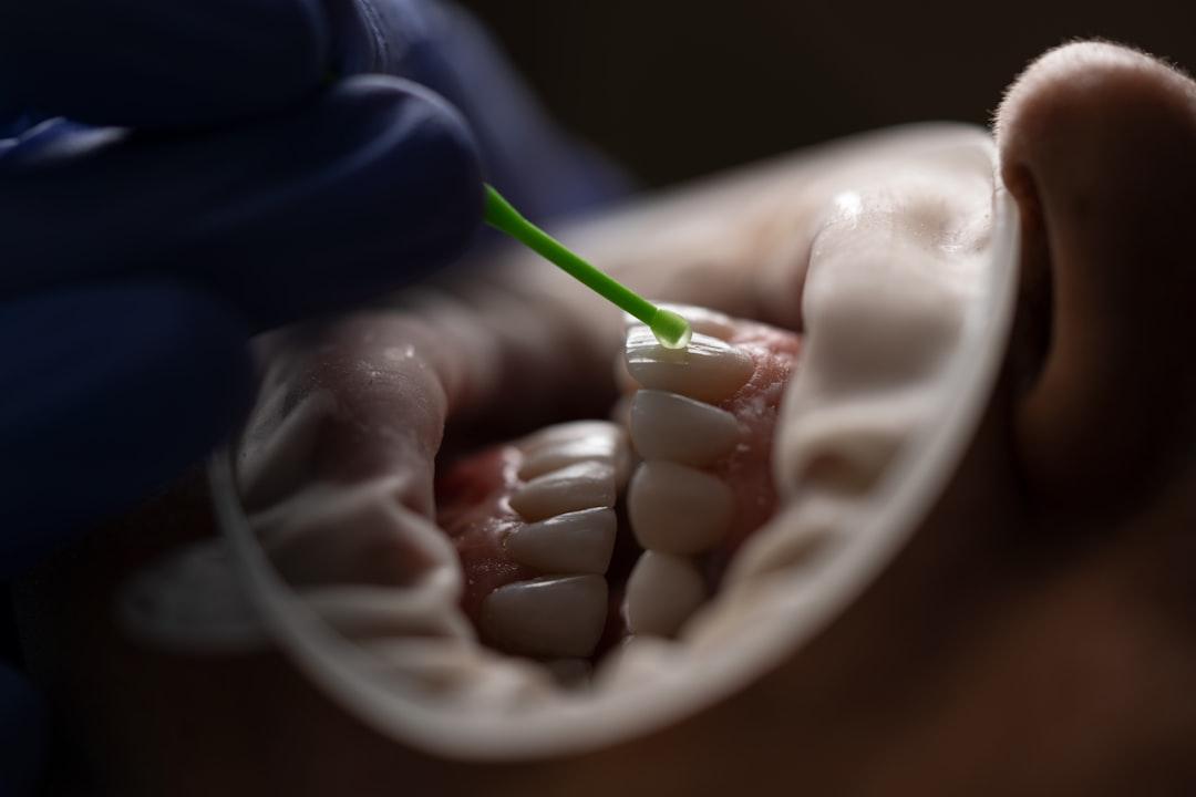 découvrez l'importance de l'hygiène dentaire pour préserver la santé de vos dents et de vos gencives, prévenir les caries et bénéficier d'un sourire éclatant au quotidien.