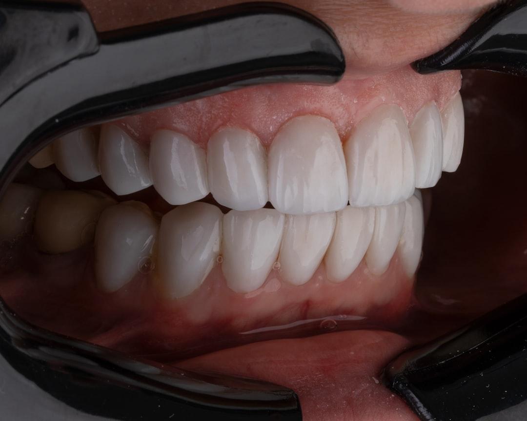 découvrez l'importance de l'hygiène dentaire : conseils pratiques, gestes quotidiens et astuces pour garder des dents saines et un sourire éclatant tout au long de votre vie.