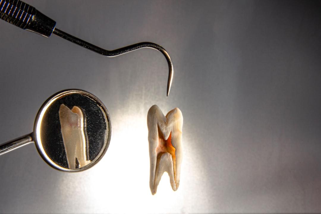 découvrez comment se déroule une visite chez le dentiste, de la prise de rendez-vous au contrôle de votre santé bucco-dentaire, pour une expérience sereine et sans stress.
