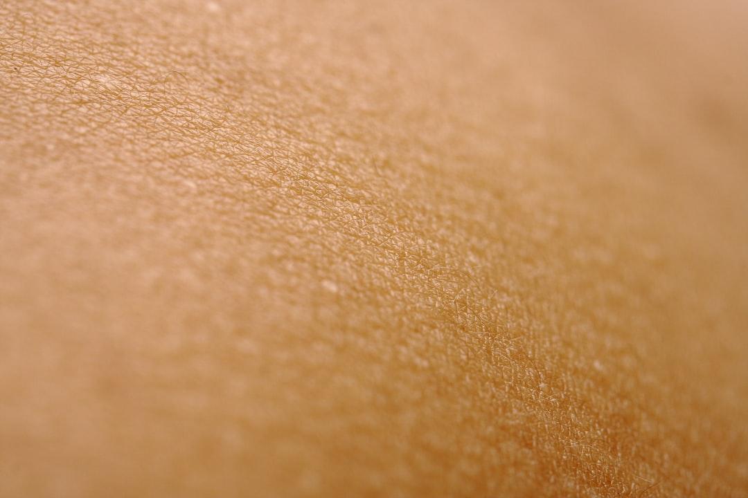 découvrez tout sur l’eczéma : ses causes, ses symptômes, les conseils pour soulager les démangeaisons et les traitements efficaces pour améliorer votre qualité de vie.