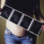 Tout ce qu'il faut savoir sur les échographies prénatales découvrez tout ce qu'il faut savoir sur les échographies prénatales : utilité, déroulement, fréquence et précautions pour suivre sereinement la santé de votre bébé pendant la grossesse.