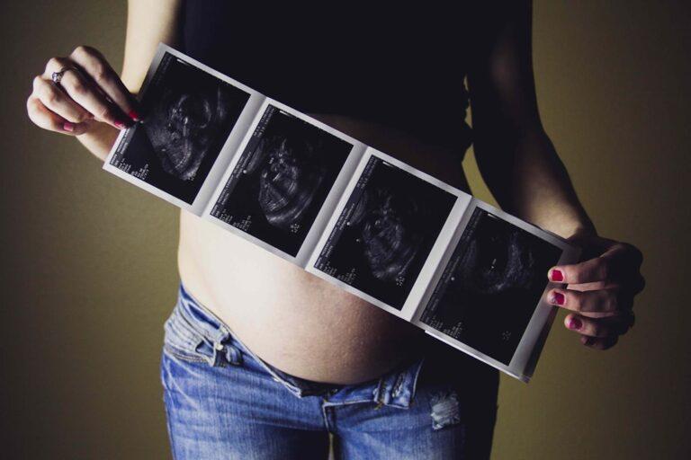 découvrez tout ce qu'il faut savoir sur les échographies prénatales : utilité, déroulement, fréquence et précautions pour suivre sereinement la santé de votre bébé pendant la grossesse.